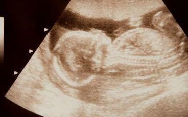 青海省助孕机构推荐 附影响青海体外受精成功率的因素