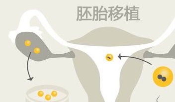 南宁妇幼做试管婴儿要多少钱(2026南宁助孕子费用参考)